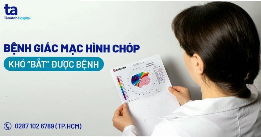 Cận cảnh cấu trúc giác mạc hình chóp