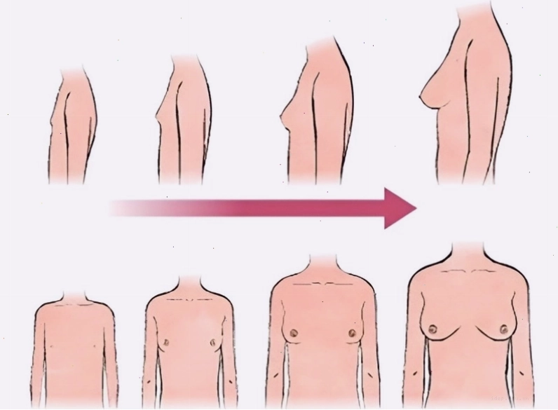 Chăm sóc sức khỏe vòng 1 bằng cách chọn áo ngực phù hợp