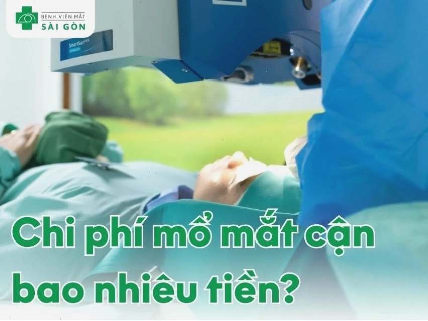 Chi phí mổ mắt cận thị mới nhất và tư vấn chuyên sâu