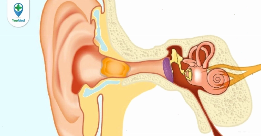 Cholesteatoma: nguyên nhân, triệu chứng, cách điều trị và phòng ngừa
