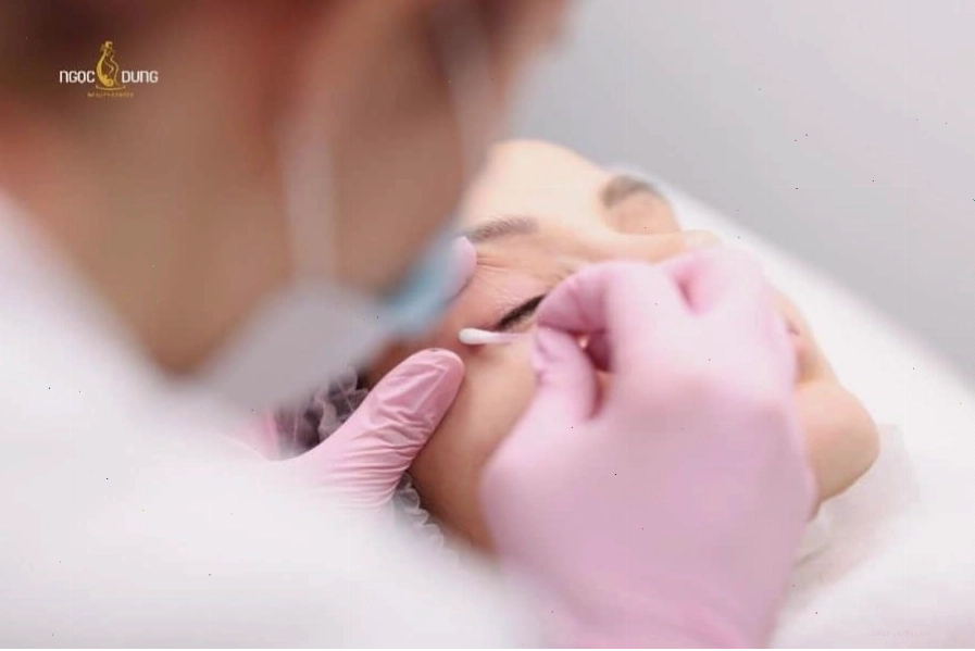 Chọn cơ sở xóa xăm mí uy tín để đảm bảo an toàn