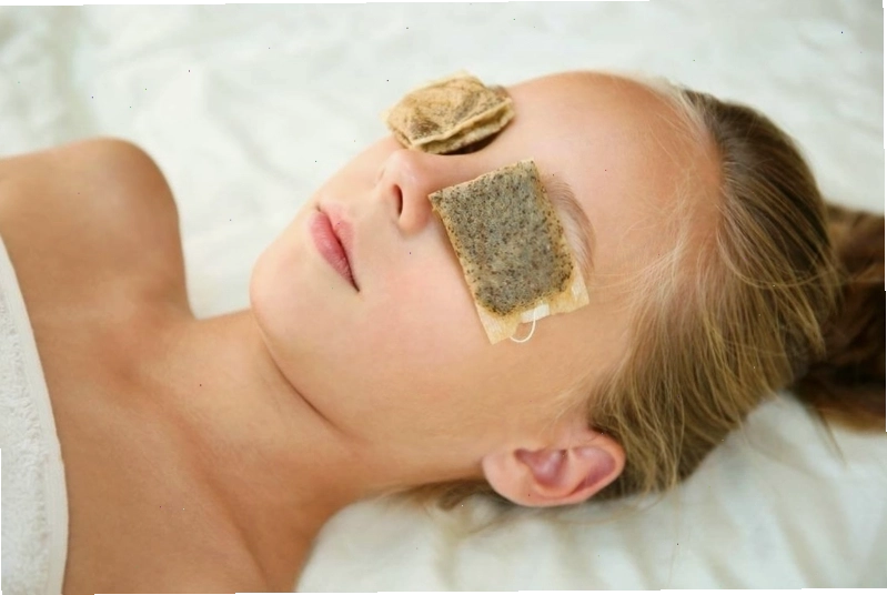 Chườm ấm giúp giảm sưng đau do lẹo mắt