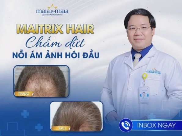 Công nghệ triệt lông bằng laser giúp tóc không mọc lại
