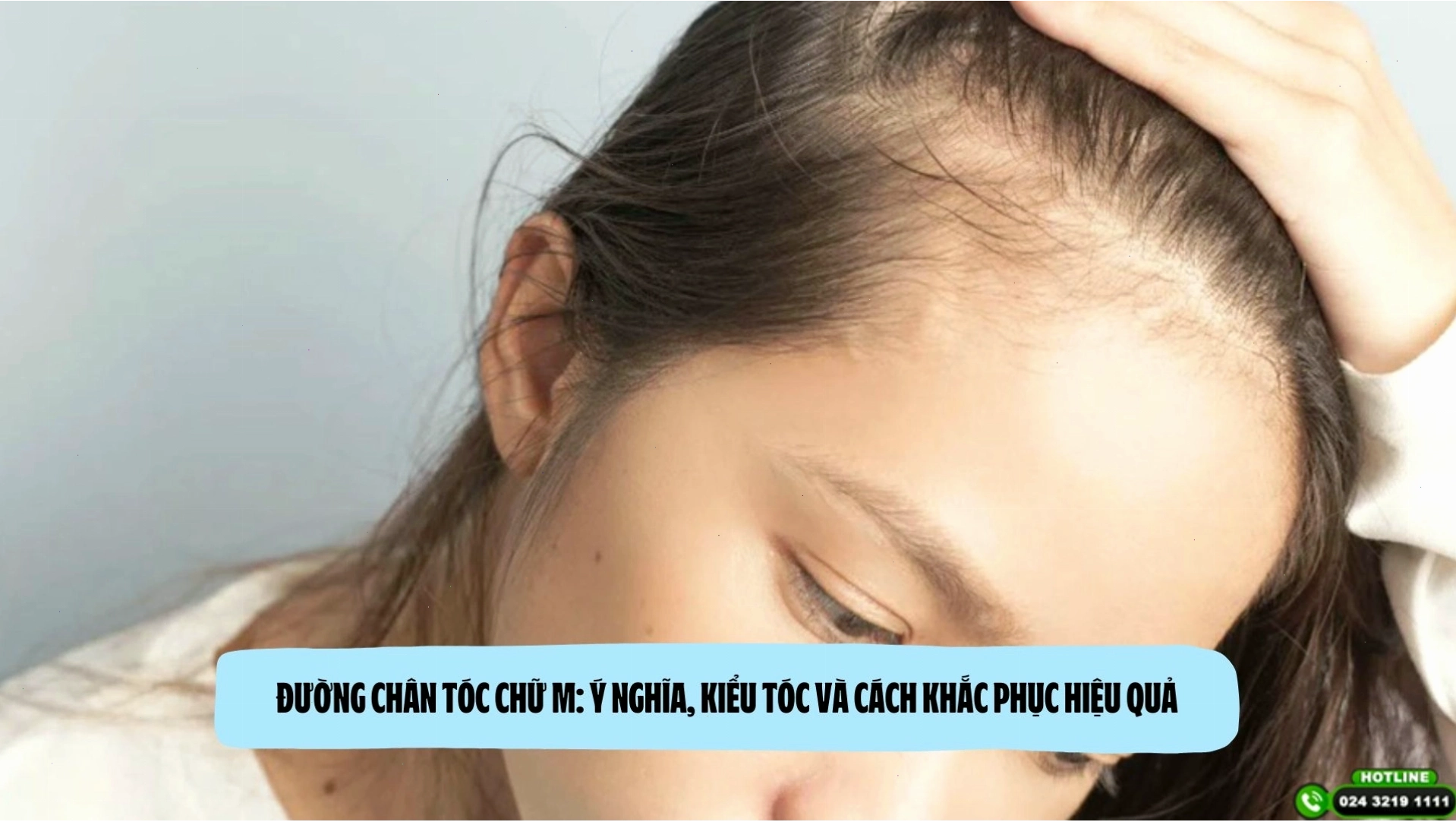 Đường chân tóc chữ M ở nam giới thường liên quan đến ý chí mạnh mẽ