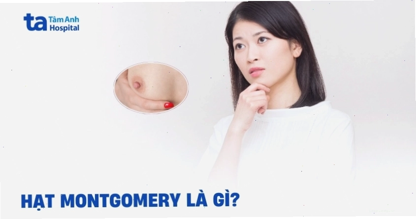 Hạt Montgomery quanh nhũ hoa