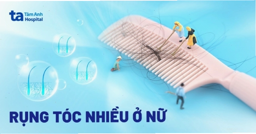 Hiểu rõ nguyên nhân rụng tóc nhiều ở nữ giới để có biện pháp phòng ngừa