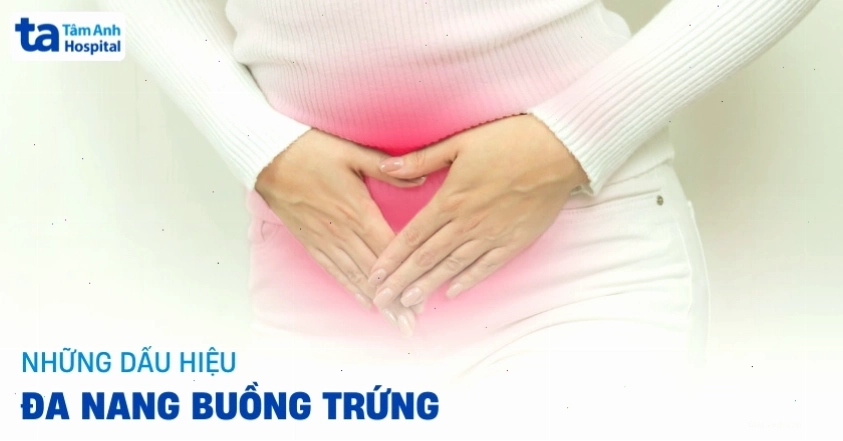 Hình ảnh minh họa các dấu hiệu của hội chứng buồng trứng đa nang