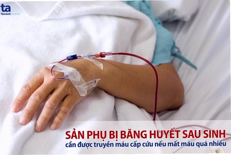 Hình ảnh minh họa các nguyên nhân gây băng huyết sau sinh thường gặp