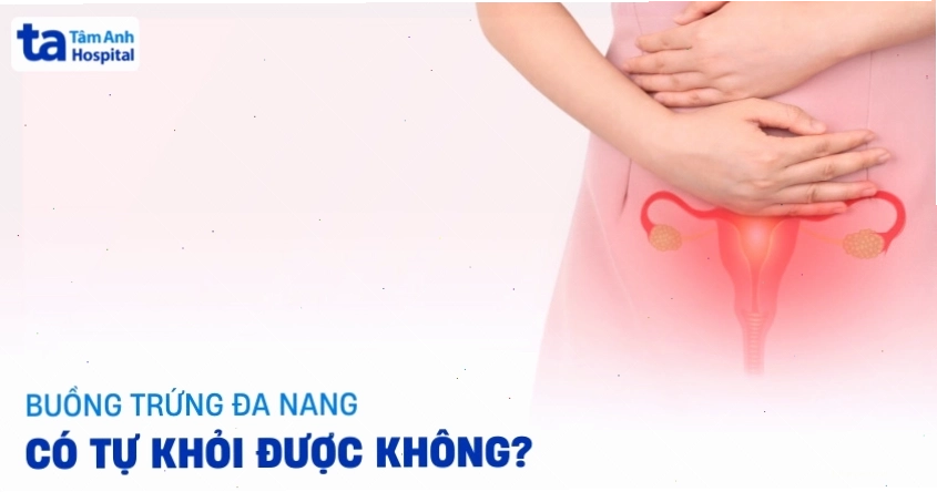 Hình ảnh minh họa người phụ nữ đang tư vấn bác sĩ về bệnh buồng trứng đa nang
