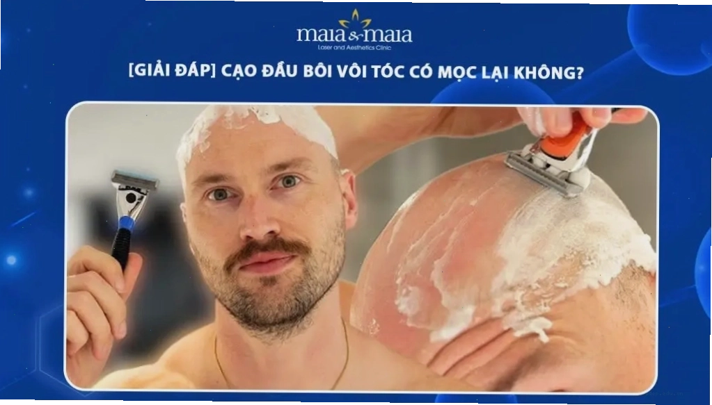 Hình ảnh minh họa quá trình cạo đầu và sự mọc lại của tóc