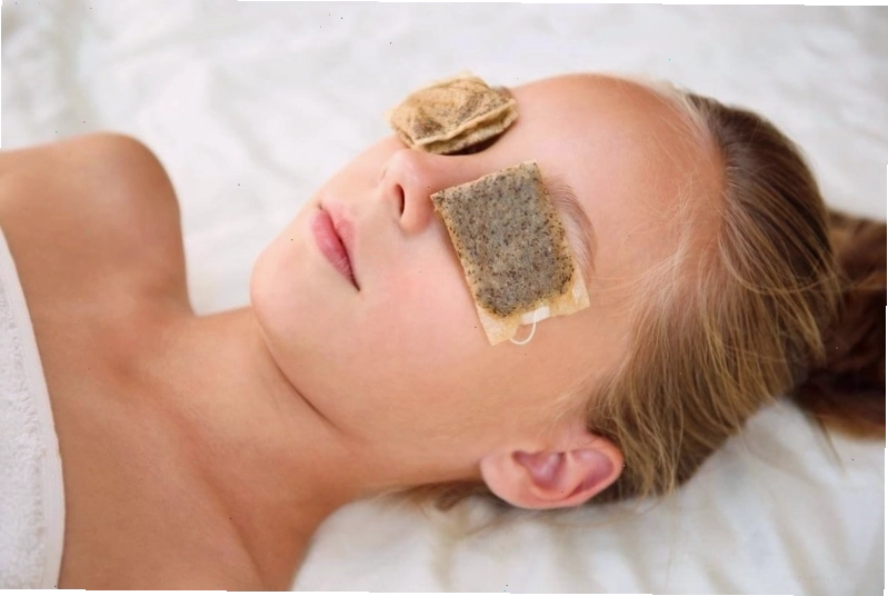 Hình ảnh minh họa tình trạng sưng đỏ do lẹo mắt