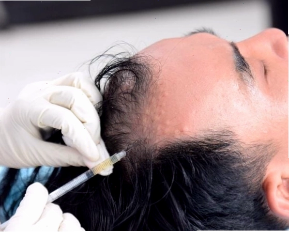 Kích thích mọc tóc bằng dầu dừa và các nguyên liệu tự nhiên