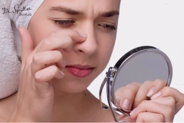 Lựa chọn phương pháp điều trị phù hợp để trị mụn nhọt ở mũi hiệu quả