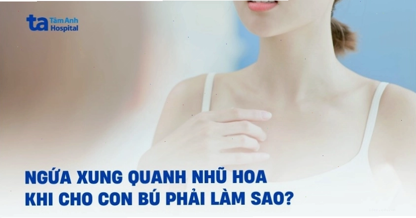 Mẹ bỉm có thể gặp ngứa xung quanh nhũ hoa khi cho con bú, cần tìm hiểu nguyên nhân