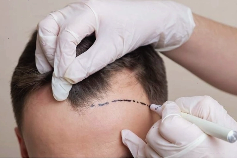 Mẹo khắc phục nhược điểm tóc bò liếm chỉ với vài thao tác đơn giản