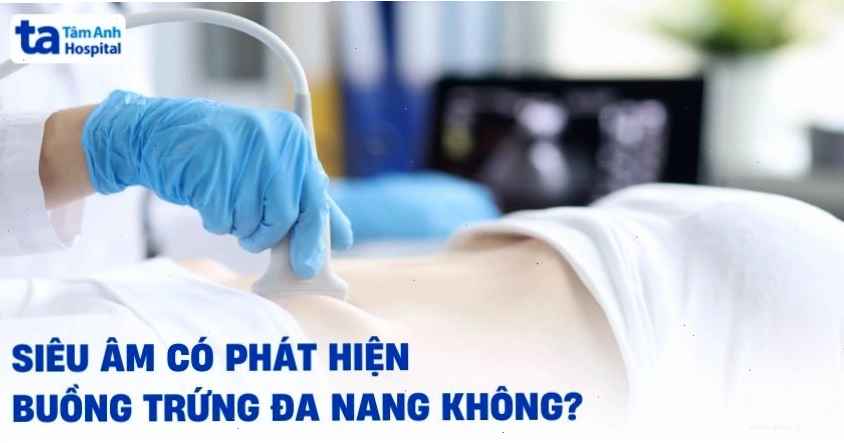 Minh họa quy trình siêu âm chẩn đoán bệnh buồng trứng đa nang