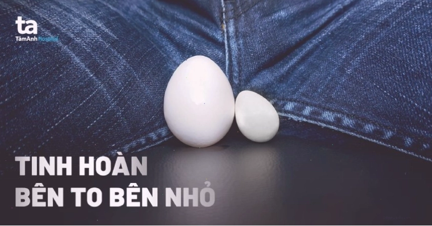 Minh họa sự khác biệt kích thước giữa hai tinh hoàn