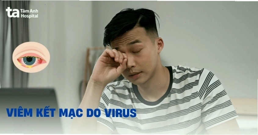 Minh họa virus gây bệnh viêm kết mạc