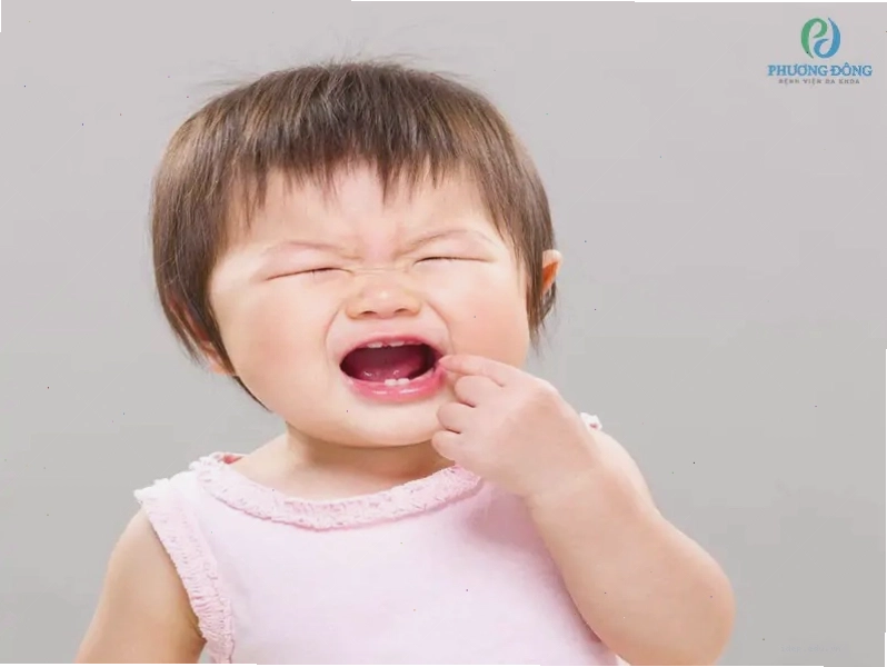 Mọc răng là nguyên nhân gây sốt ở trẻ
