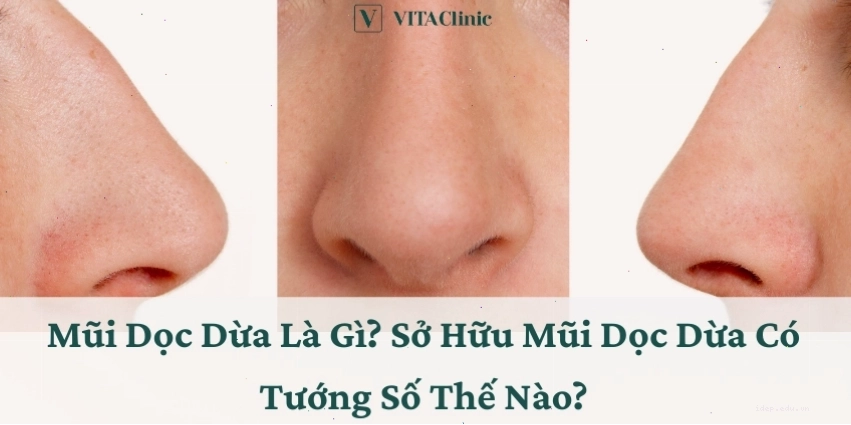 Mũi Dọc Dừa Là Gì? Sở Hữu Mũi Dọc Dừa Có Tướng Số Thế Nào?