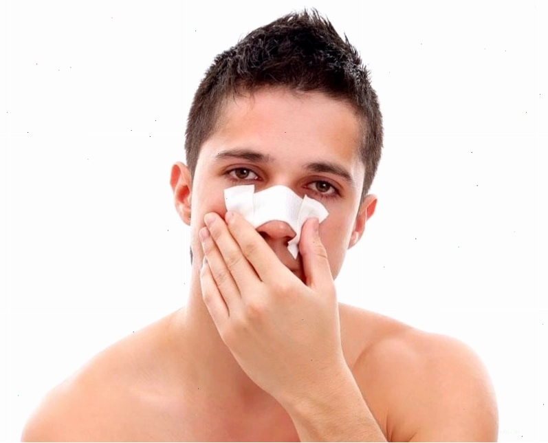 Mụn có thể xuất hiện trong mũi sau phẫu thuật hoặc chấn thương vùng mũi