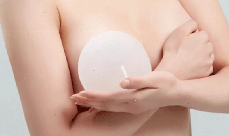 Nâng ngực bao lâu thì hết đau? Giai đoạn hồi phục 2-6 tuần.
