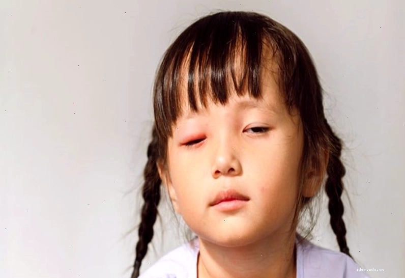 Nếu mắt có vấn đề bất thường cần phải đi khám sớm