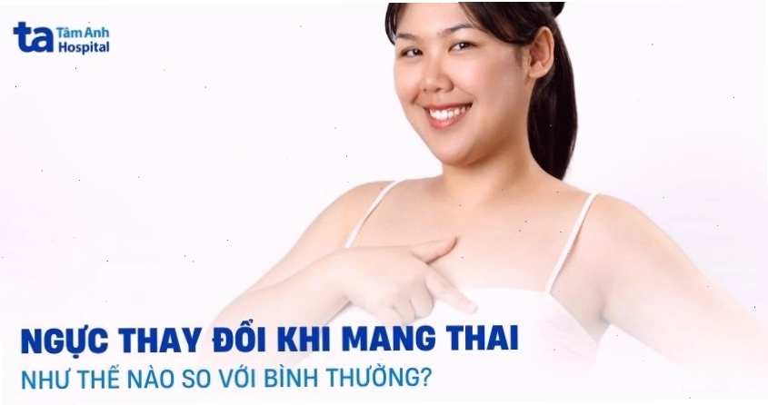 Ngực thay đổi khi mang thai, có cảm giác căng tức và nặng nề