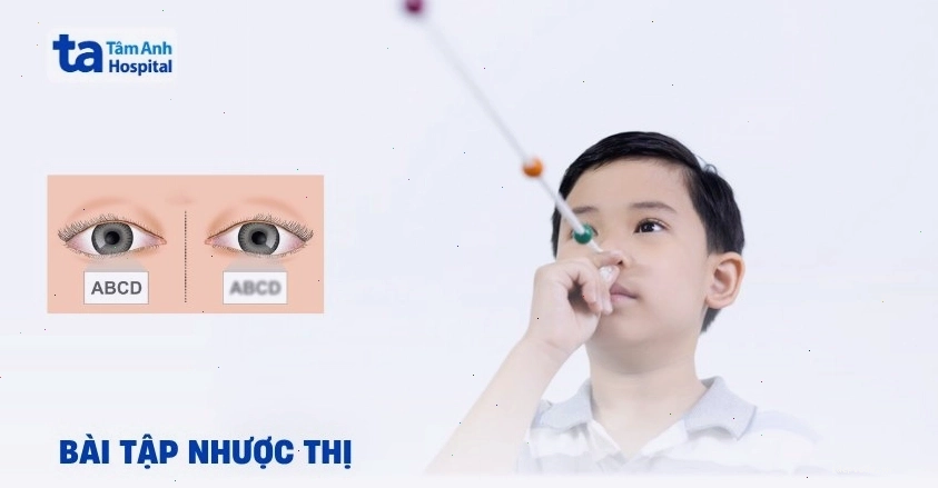 Người bệnh tập luyện các bài tập cho mắt