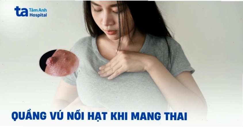 Nhũ hoa có hạt trắng khi mang thai