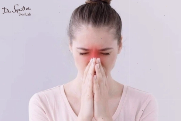 Nổi mụn nhọt trong mũi khiến khổ chủ vô cùng khó chịu, cần thăm khám bác sĩ nếu nặng