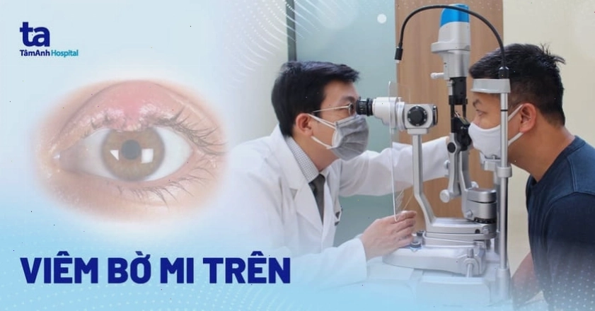 Phân biệt viêm bờ mi trước và sau