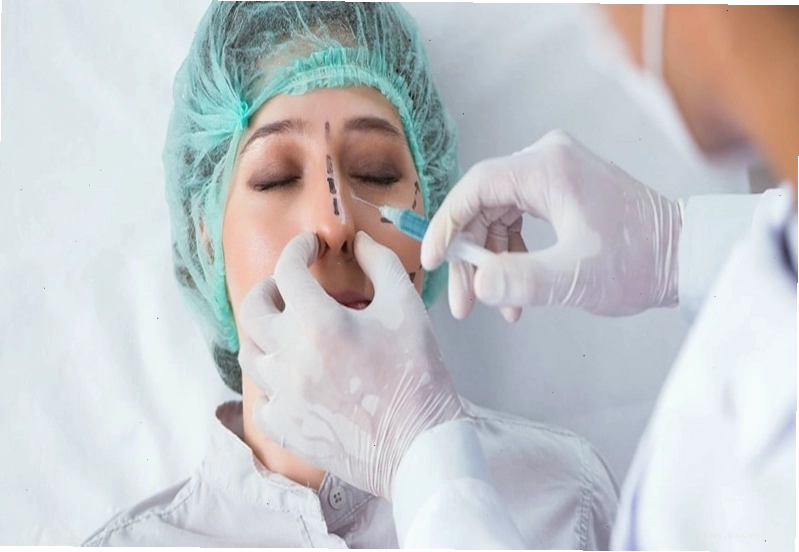 Phẫu thuật là phương pháp thường được chỉ định trong điều trị mũi lệch do vách ngăn