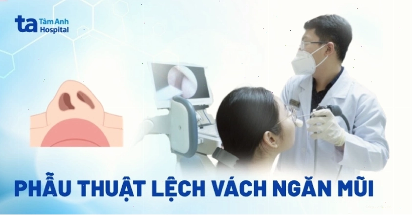 Phẫu thuật lệch vách ngăn mũi