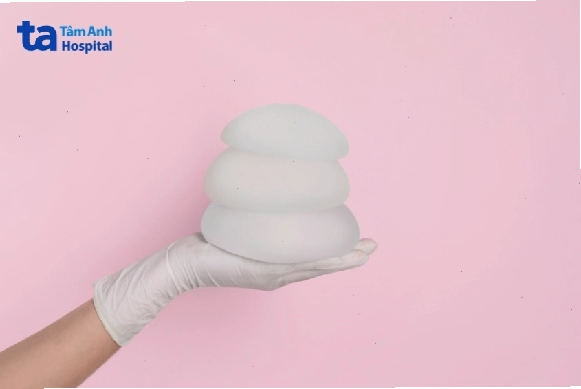 Phẫu thuật nâng ngực bằng túi độn silicone