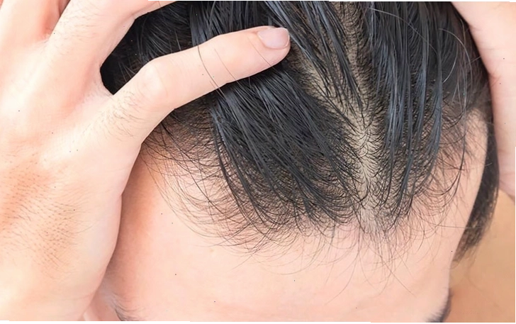Quá trình mọc tóc mới