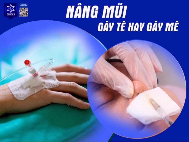 Quy trình tiền mê và nâng mũi an toàn tại bệnh viện thẩm mỹ uy tín