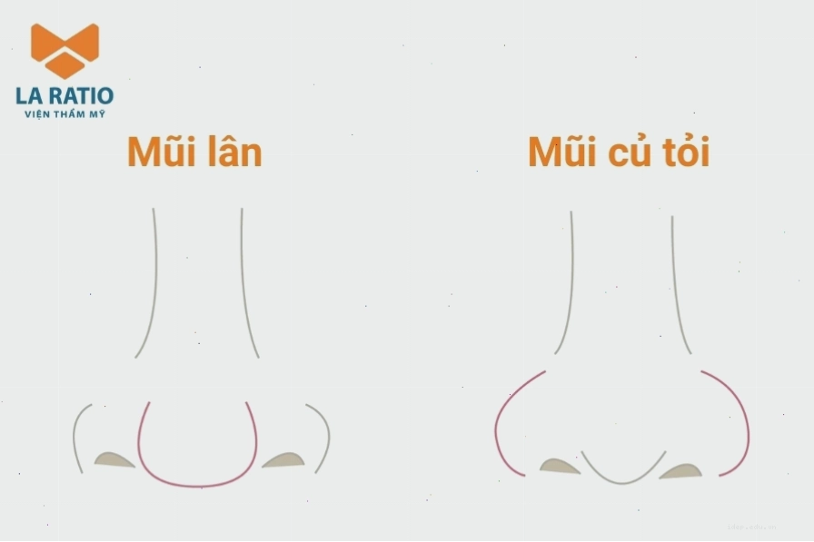 So sánh dáng mũi củ tỏi và mũi lân