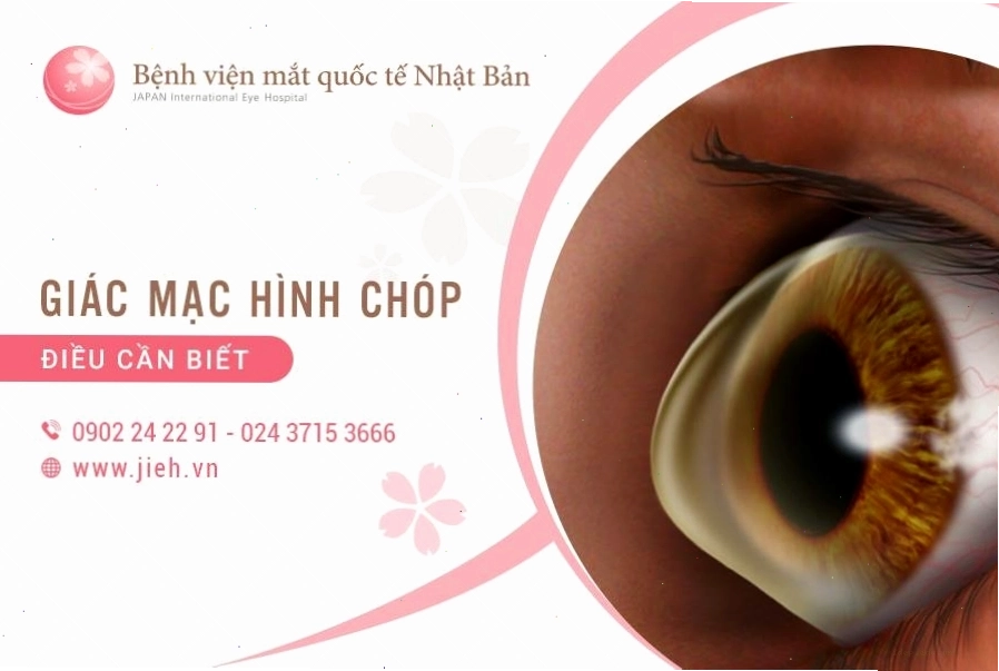 So sánh giác mạc bình thường và giác mạc hình chóp