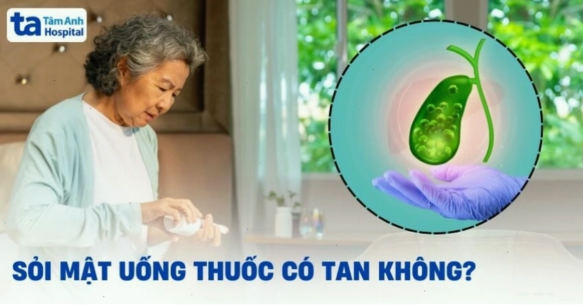 Sỏi mật uống thuốc có tan không? Ưu, nhược điểm khi dùng