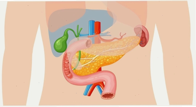 Sỏi túi mật - một dạng bệnh lý lành tính, không quá nguy hiểm