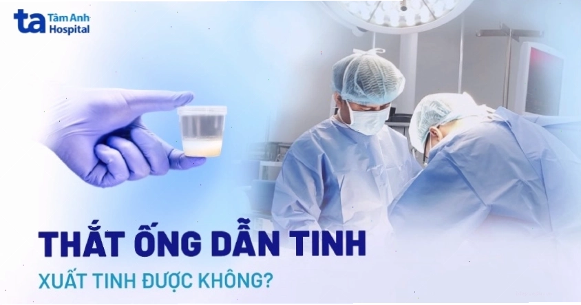 Thắt ống dẫn tinh có xuất tinh được không? Giải đáp chi tiết