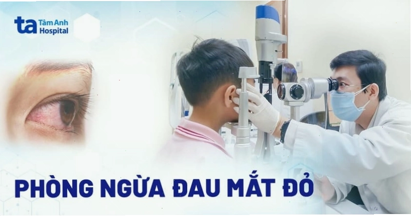 Thường xuyên rửa tay là biện pháp phòng ngừa đau mắt đỏ hiệu quả