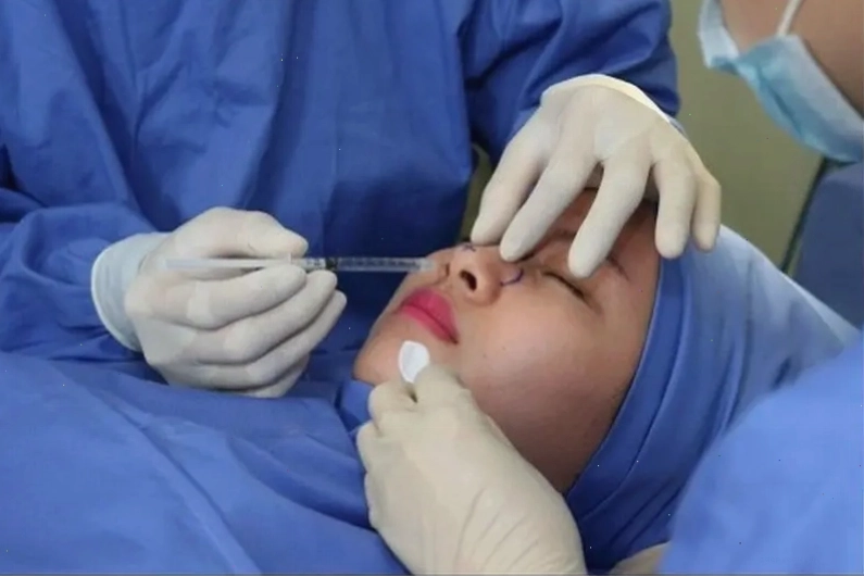 Tiền mê trước phẫu thuật nâng mũi là phương pháp an toàn khi được thực hiện đúng quy trình