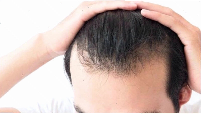 Tóc bò liếm là phần tóc mọc dựng đứng, không theo nếp