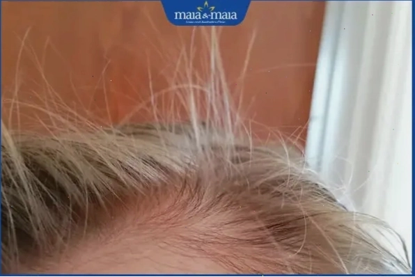 Tóc con mọc trên đầu và cách tạo kiểu
