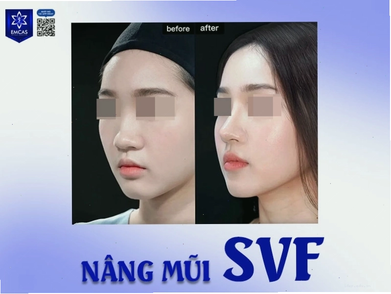 Tướng số nam giới sở hữu mũi củ tỏi