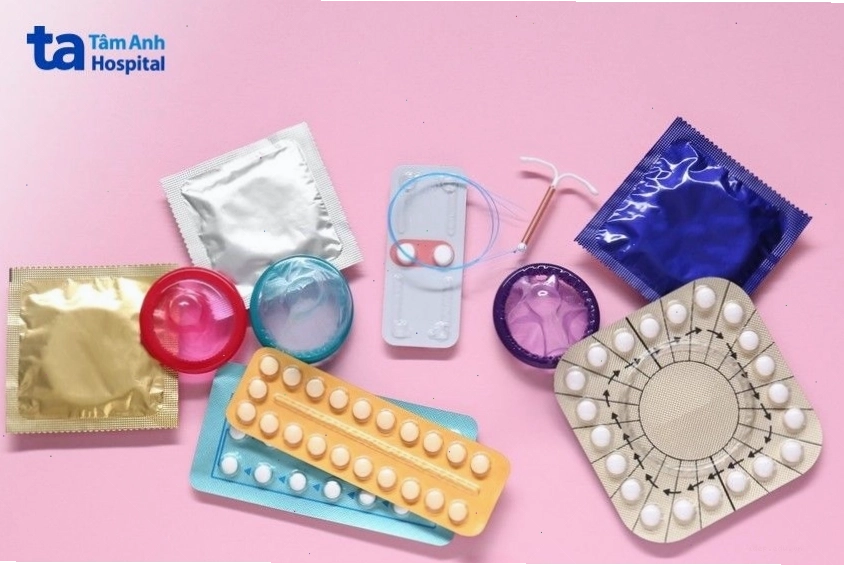 Ưu nhược điểm của thắt ống dẫn tinh