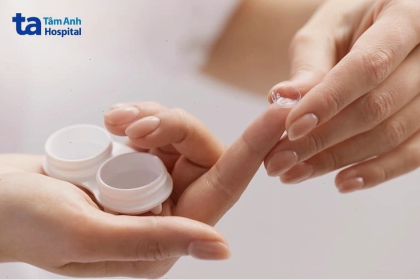 Vi khuẩn là một trong những nguyên nhân chính gây bệnh đau mắt đỏ
