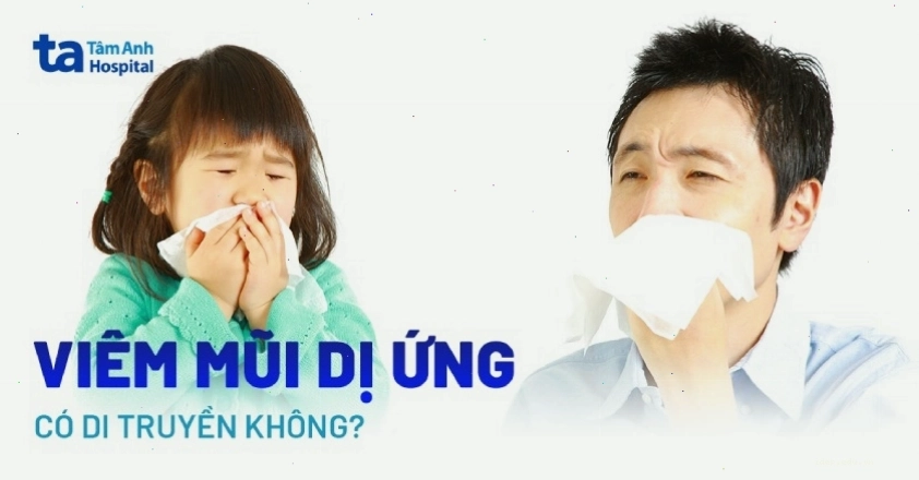 Viêm mũi dị ứng có thể có yếu tố di truyền